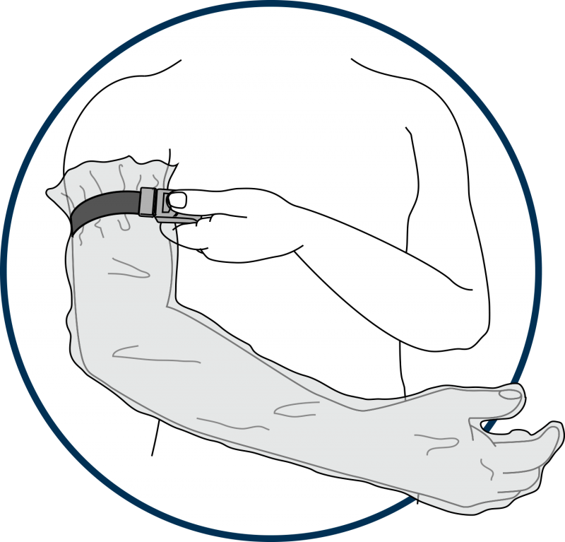 HydroSeal Glove/Sleeve strapped on the arm