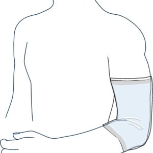 A sketch showing a medical arm protection sleeve